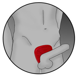 ELECTRASTIM - SILIKONOWA FUSION VIPER SHIELD